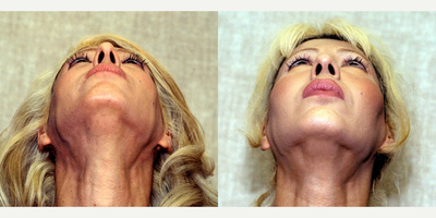 before and after image