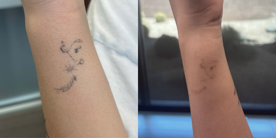 before and after image