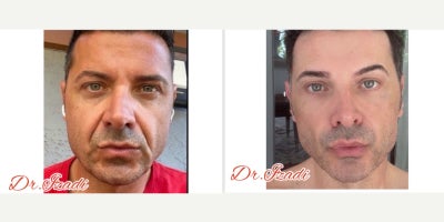 before and after image
