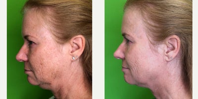 before and after image