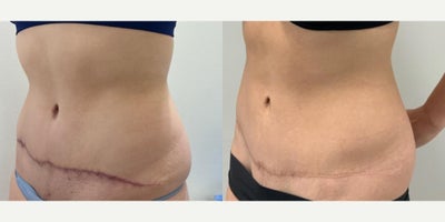 before and after image