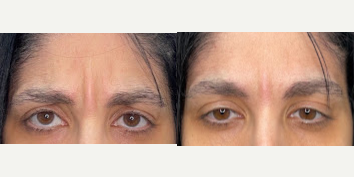 before and after image