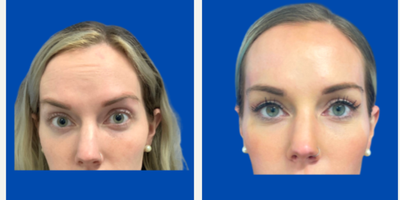 before and after image