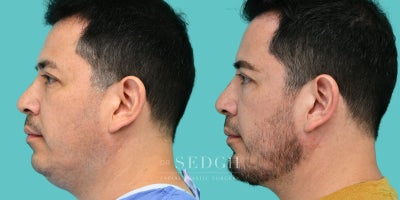 before and after image