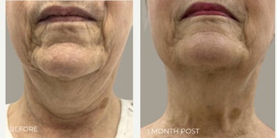 before and after image