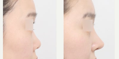 before and after image