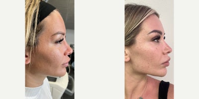 before and after image