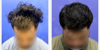 Zimmer ZWave before and after photo