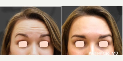 before and after image
