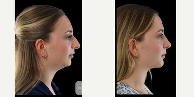 before and after image