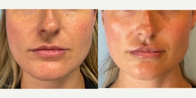 before and after image