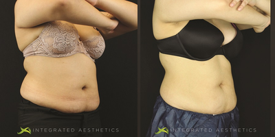 before and after image