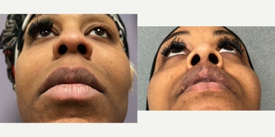 before and after image