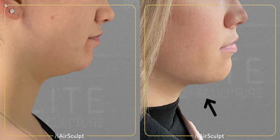 before and after image