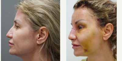 before and after image
