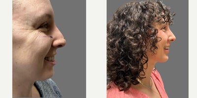 before and after image