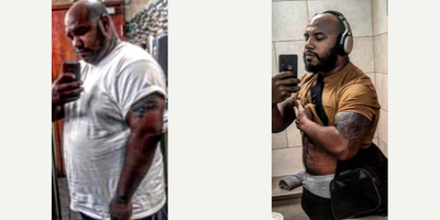 Gastric Bypass before and after photo