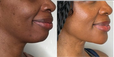 before and after image