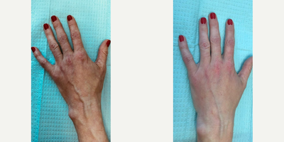 before and after image