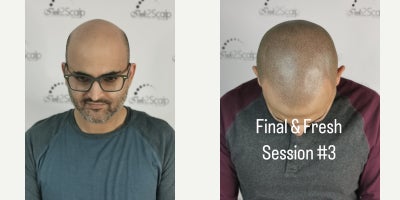 before and after image