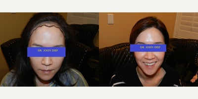 before and after image