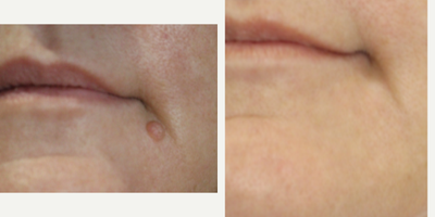 before and after image