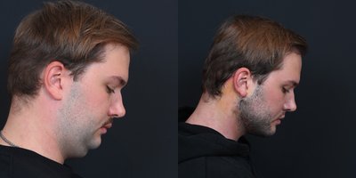 before and after image