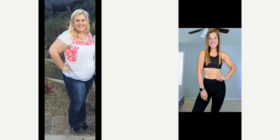 Gastric Bypass before and after photo