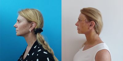 before and after image