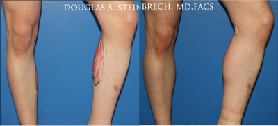 before and after image