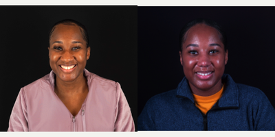 African American Rhinoplasty before and after photo