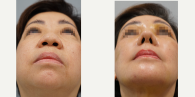 before and after image