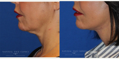 before and after image