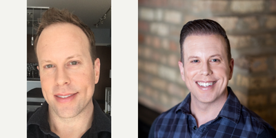 FUE Hair Transplant before and after photo