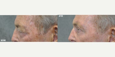 before and after image
