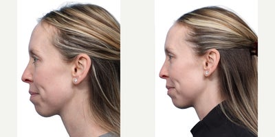 before and after image