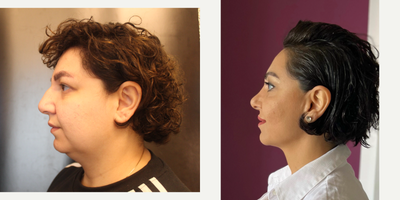 before and after image
