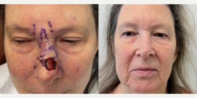 before and after image