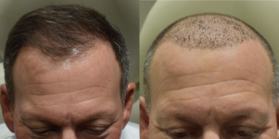 before and after image