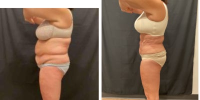 before and after image