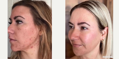 before and after image