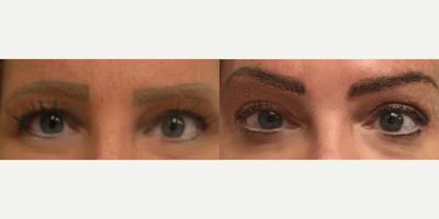 Permanent Makeup before and after photo