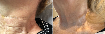 before and after image