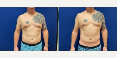 before and after image