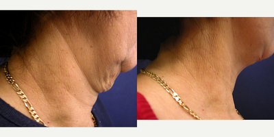 before and after image