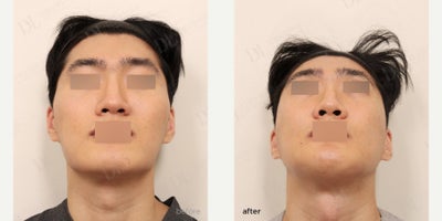 before and after image