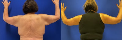 before and after image