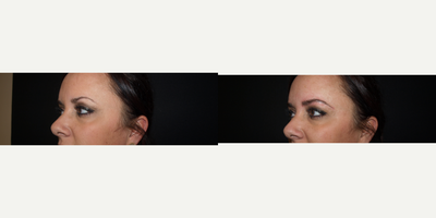 Microblading before and after photo