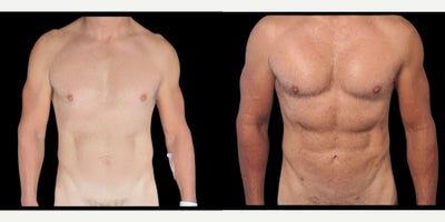 before and after image