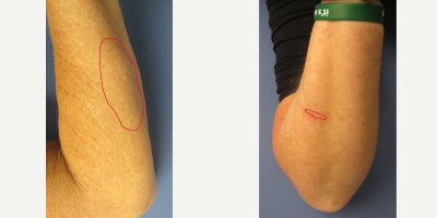 before and after image